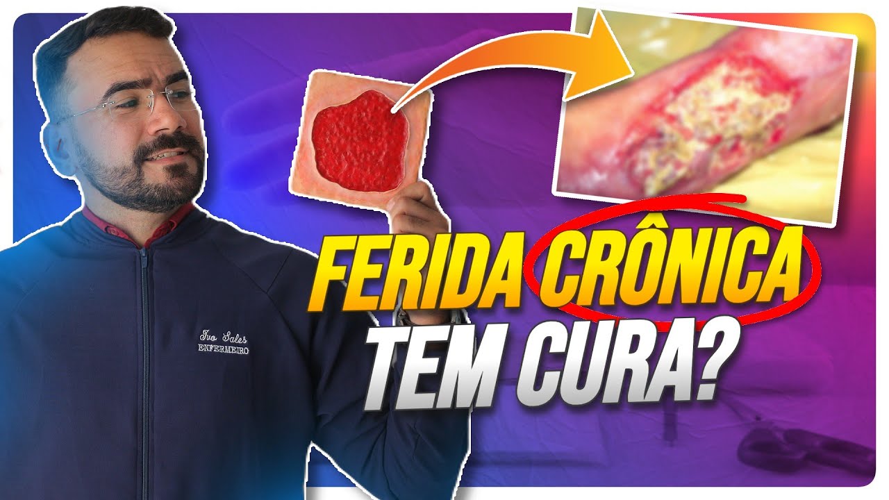 POR QUE A FERIDA CR&Ocirc;NICA DEMORA TANTO PARA CICATRIZAR? (ENTENDA OS MOTIVOS)