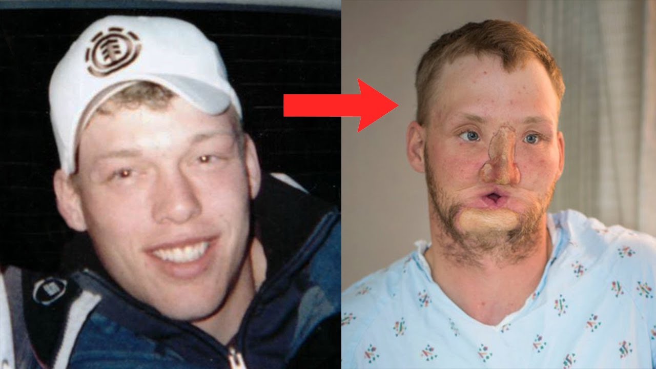 Brave Suicidal Survivor Stories To Recovery