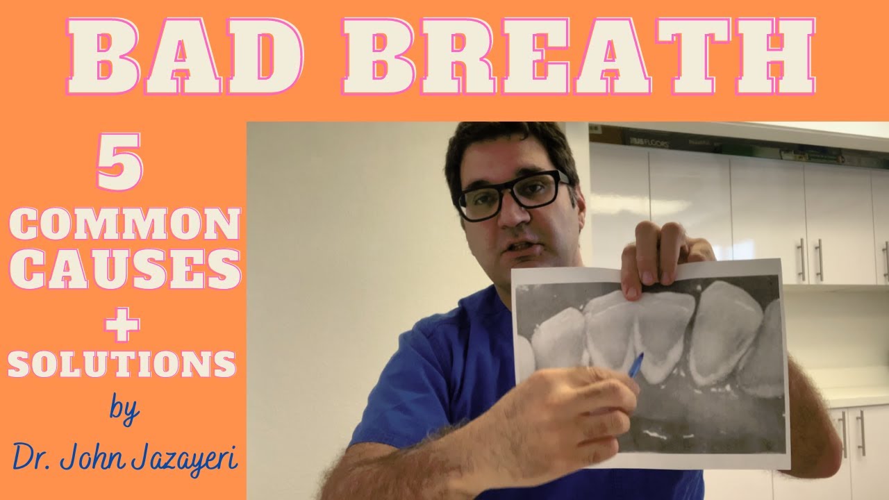 Bad Breath (Halitosis): Common Causes + Solutions