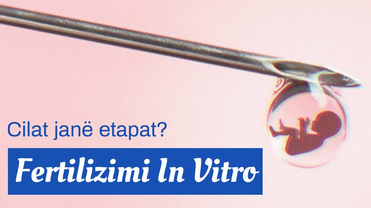 IVF (Fekondimi In Vitro) nga fillimi në fund!