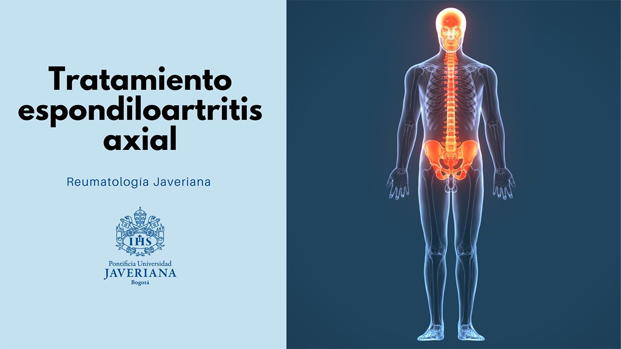 Tratamiento espondiloartritis axial