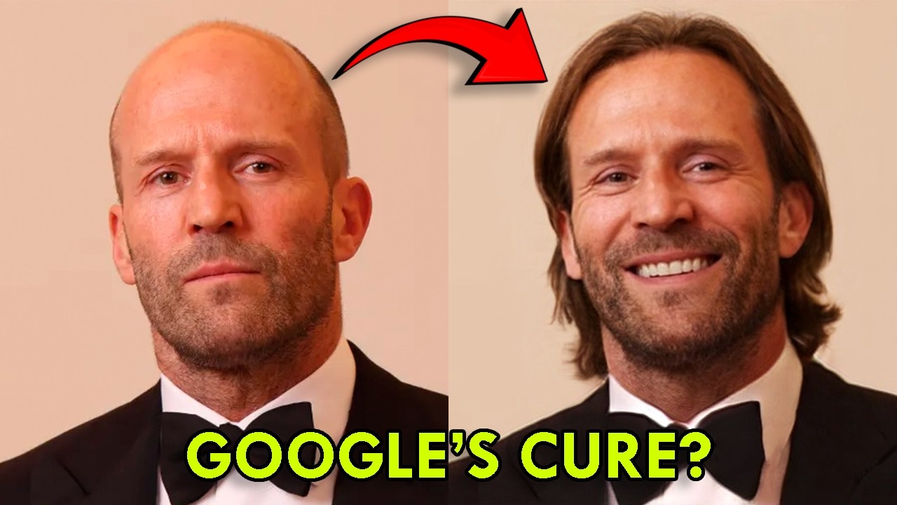 PP405 Resurrects Dead Follicles: The End Of Finasteride And Minoxidil?
