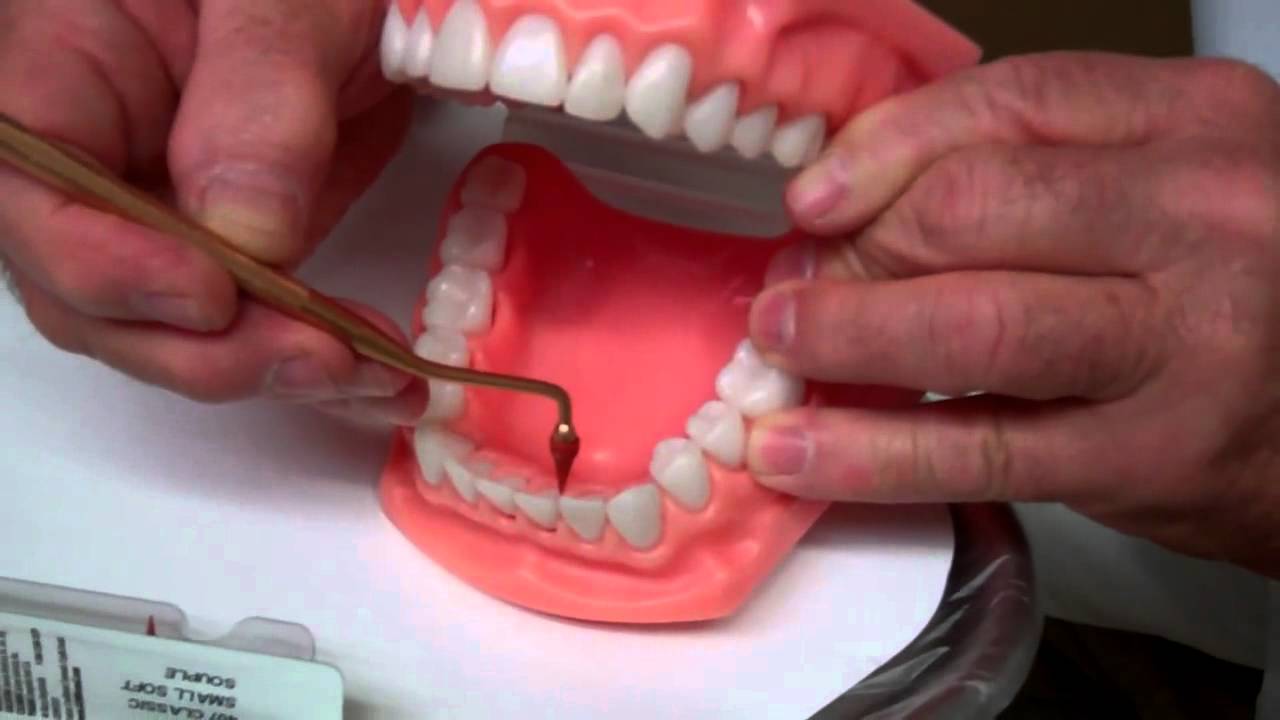 Rubber Tip Stimulator - Oral Hygiene Instructions by Dr. Berdy, periodontist Jacksonville, FL