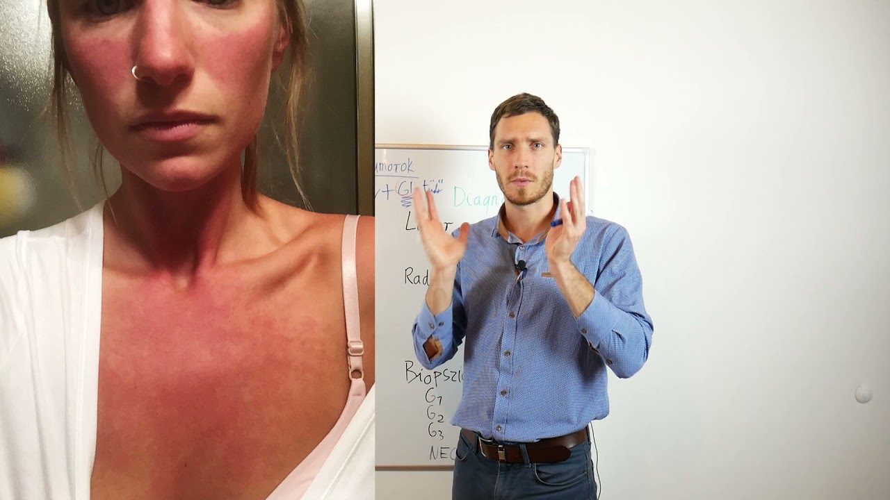 Neuroendokrin tumorok, a carcinoid szindróma - teranosztikumok?