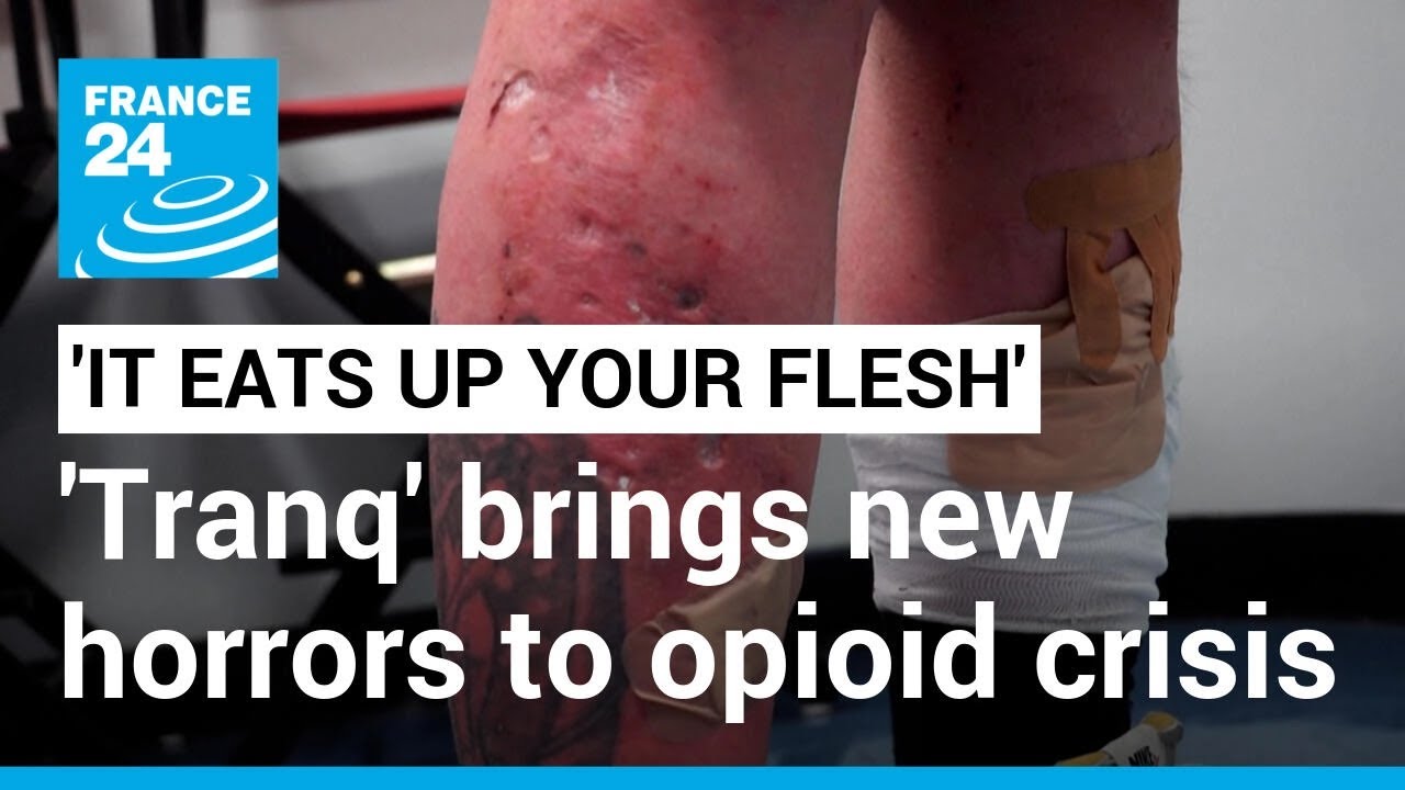 'It eats up your flesh': 'Tranq', the new drug worsening America's opioid epidemic &bull; FRANCE 24