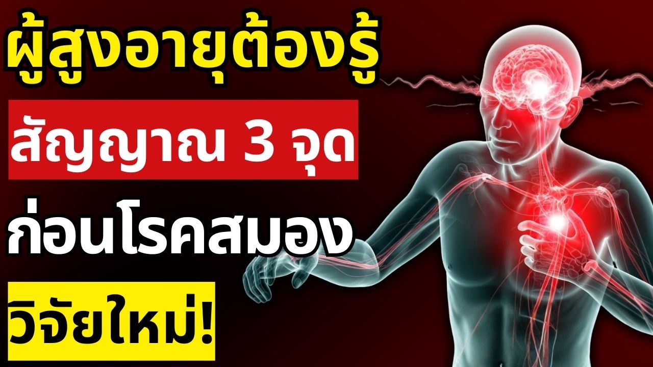 สัญญาณก่อนโรคหลอดเลือดสมองจริง! ปวด 3 จุดนี้อันตรายมาก ผู้สูงอายุต้องรู้ แพทย์ยืนยัน