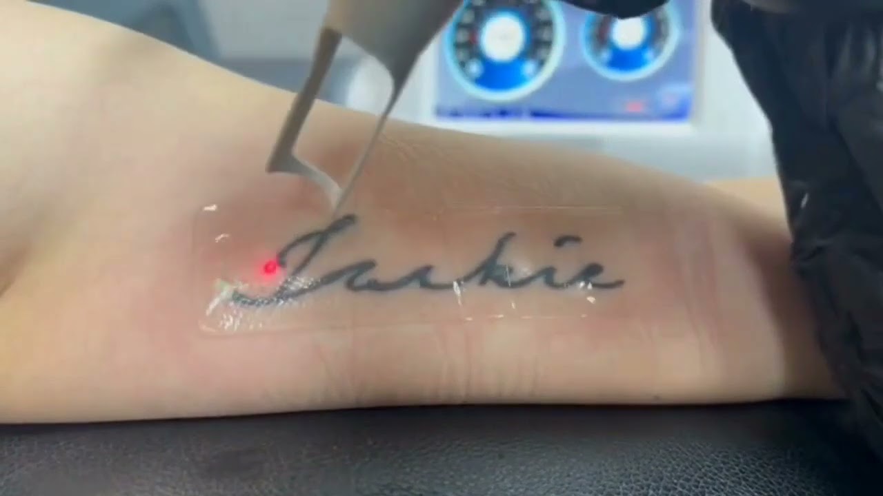 Pelicular  protectora eliminación  tatuajes sin dolor ni riesgos (Ideal para aplicar la técnica R20)
