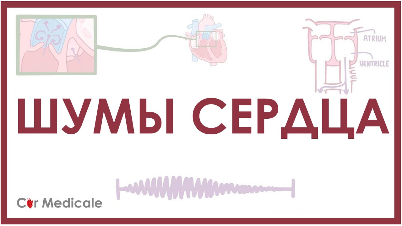Шумы сердца: примеры (слушать в наушниках), причины и механизм, виды