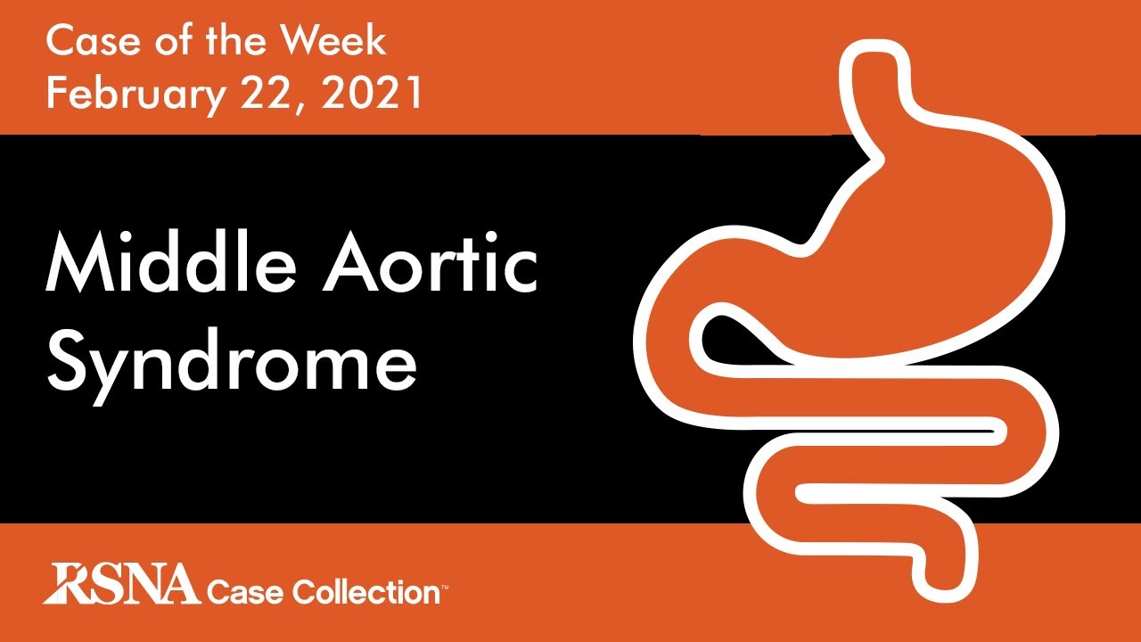 Case of the Week: Middle Aortic Syndrome
