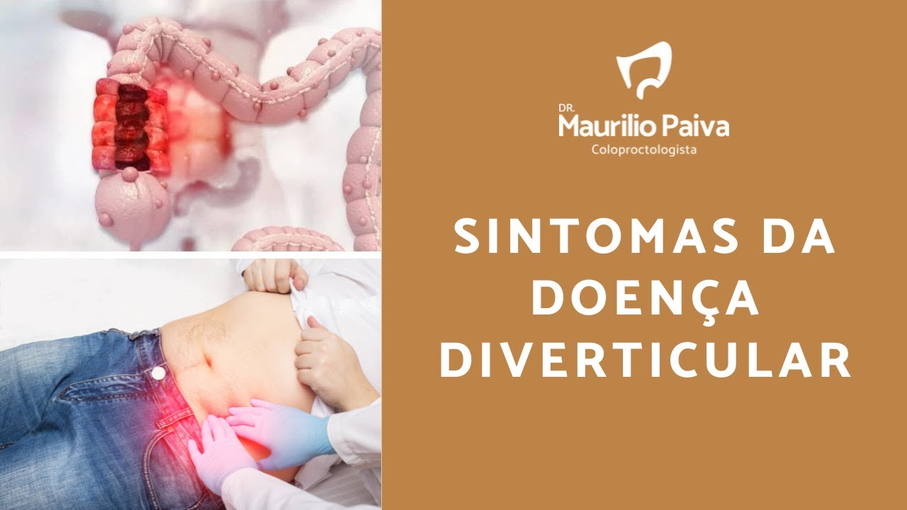Sintomas da Doen&ccedil;a Diverticular