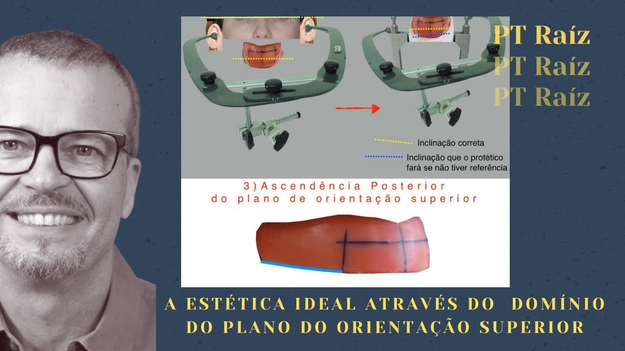 Como obter harmonia do sorriso através do plano de orientação superior em PT