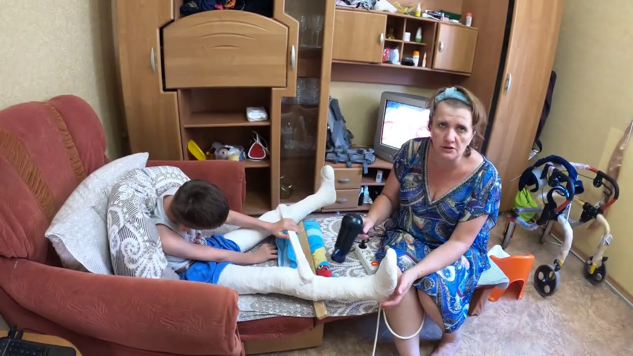 Первый этап гипсования Ярослава.Самочувствие Ярослава после гипсования. Сколько гипсов у нас ушло.