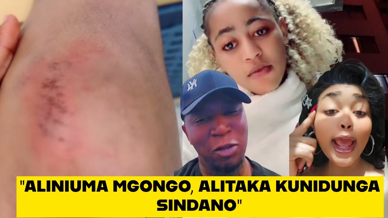 Кики мучила меня. Джило рассказывает Самиру, как она сбежала из дома Кики в полночь, показывая раны.