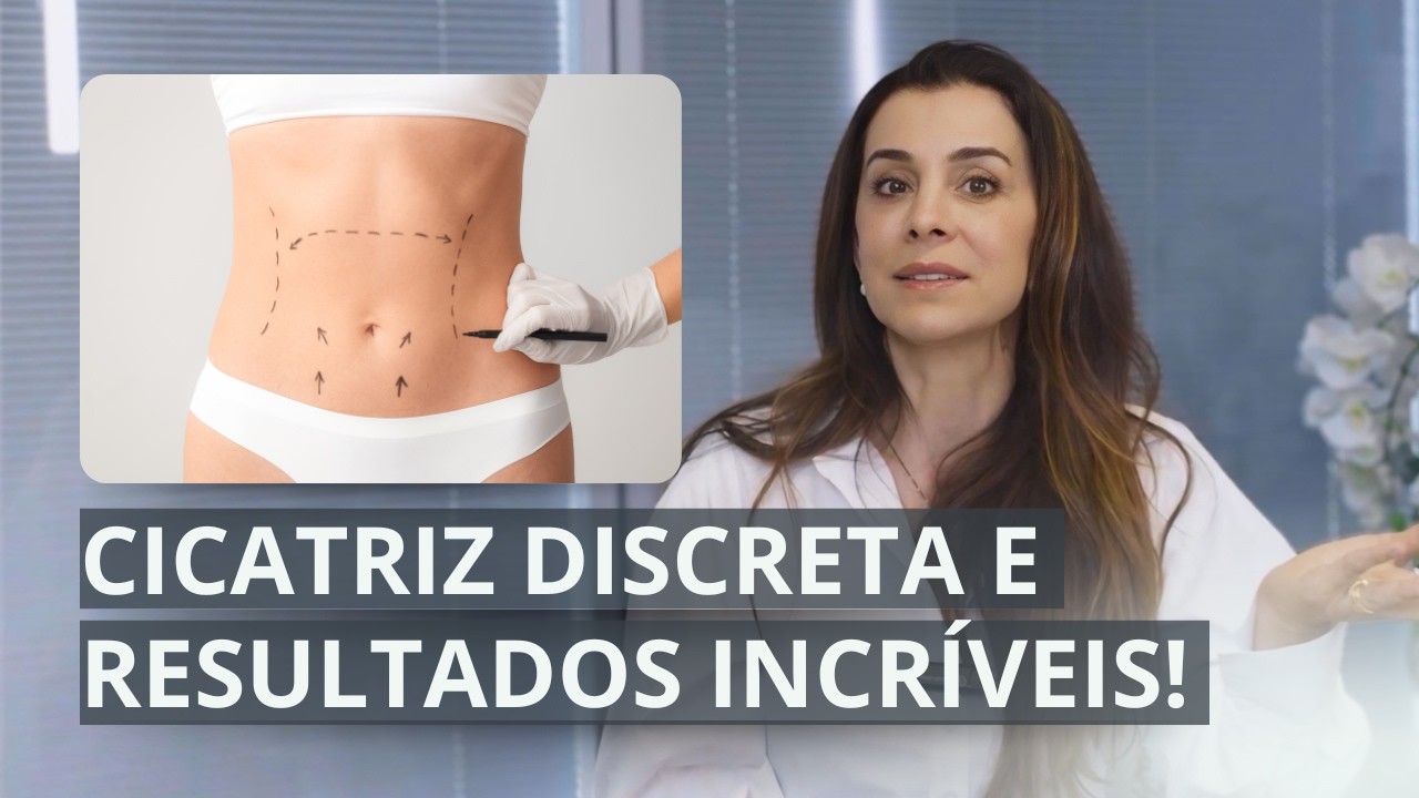 Mini Abdominoplastia: Como é feita? Para quem é indicada? Onde fica a cicatriz?