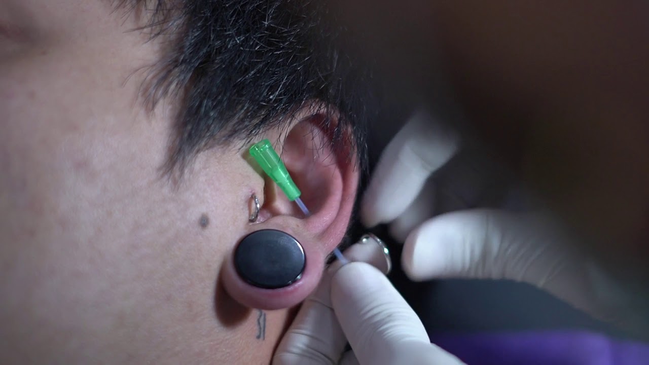 Tindik Telinga - Conch Piercing - Proses Cara Melubangi Telinga (Tindik/Piercing) di Bandung