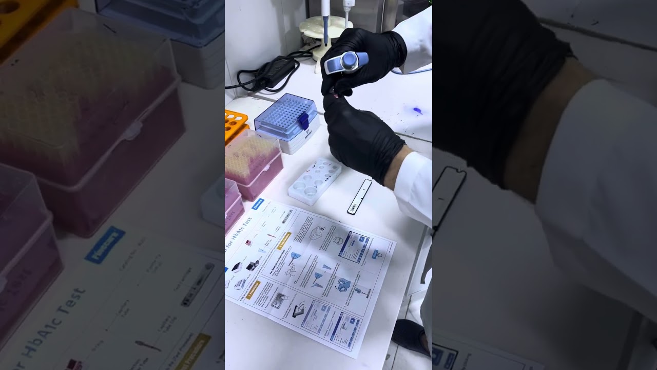 تحليل السكر التراكمي HbA1C على جهاز Finecare
