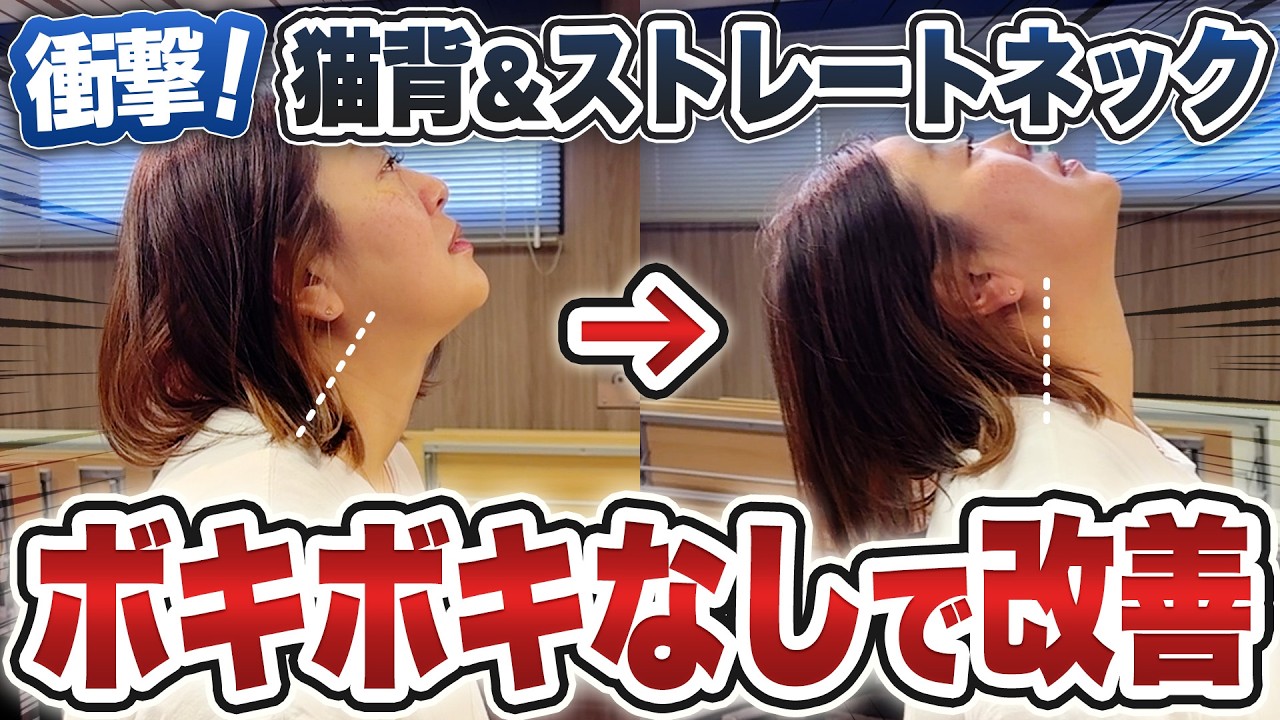 【ストレートネック 改善】ストレートネックを改善する施術法！姿勢や可動域もこの方法で完全回復！美と健康を簡単にする施術法をお伝えします。