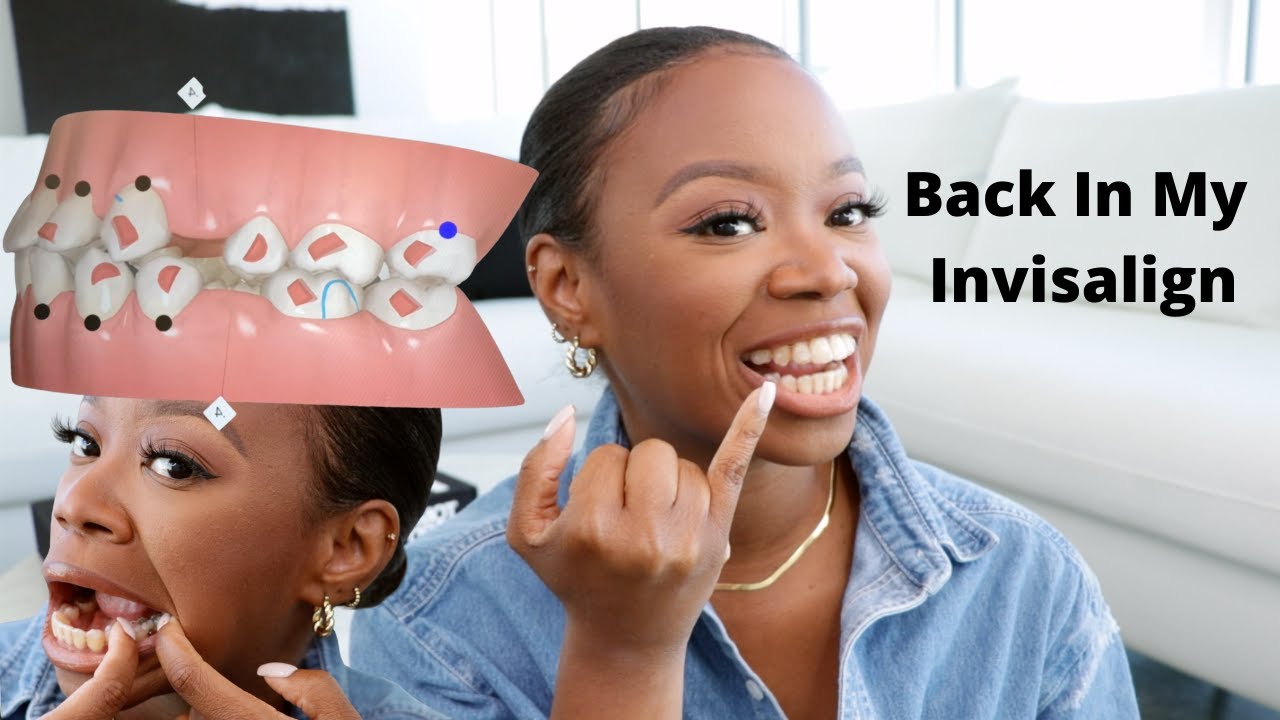 I'm BACK In My Invisalign! What Happened? Extractions Closing & Invisalign Finish Date
