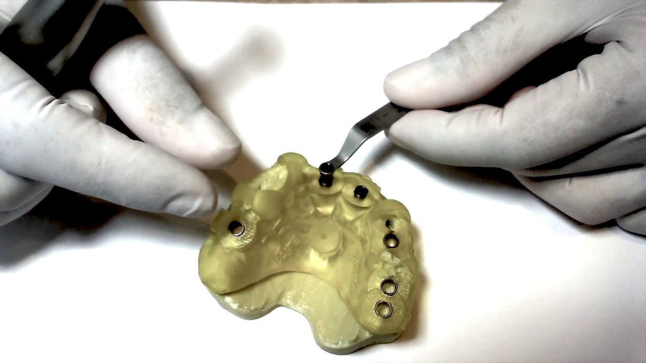 Kit Neodent Guided Surgery - Grand Morse