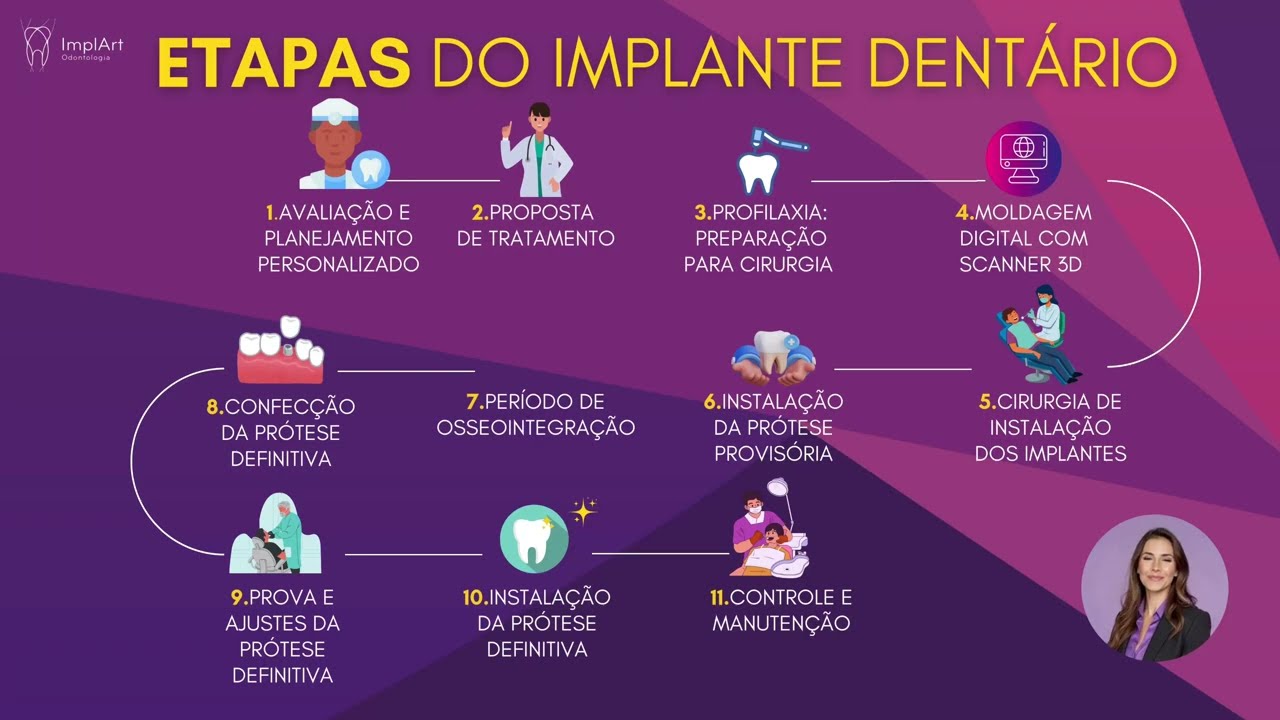 ETAPAS DO IMPLANTE DENTARIO.Como &eacute; feito um Implante Dent&aacute;rio: Conhe&ccedil;a o passo a passo do implante