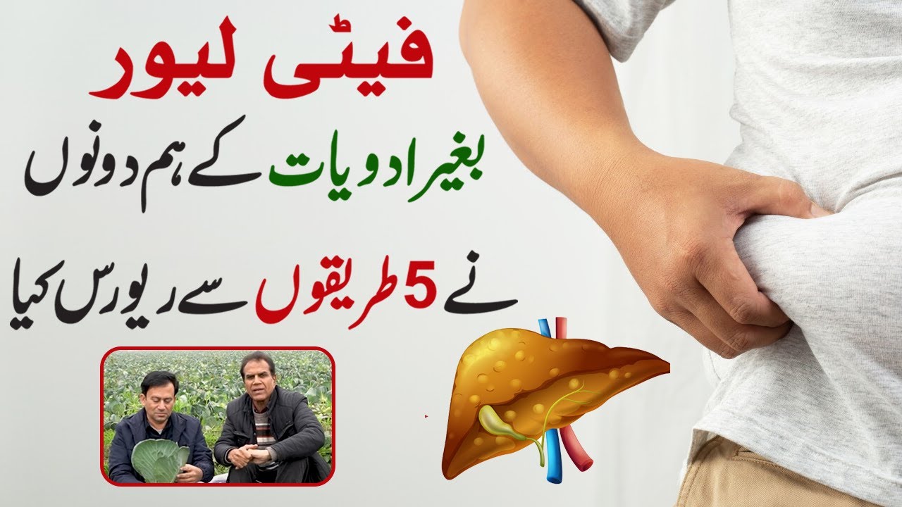 Reversing Fatty Liver Naturally: 5 Effective Approaches Without Medication | Health Tips
