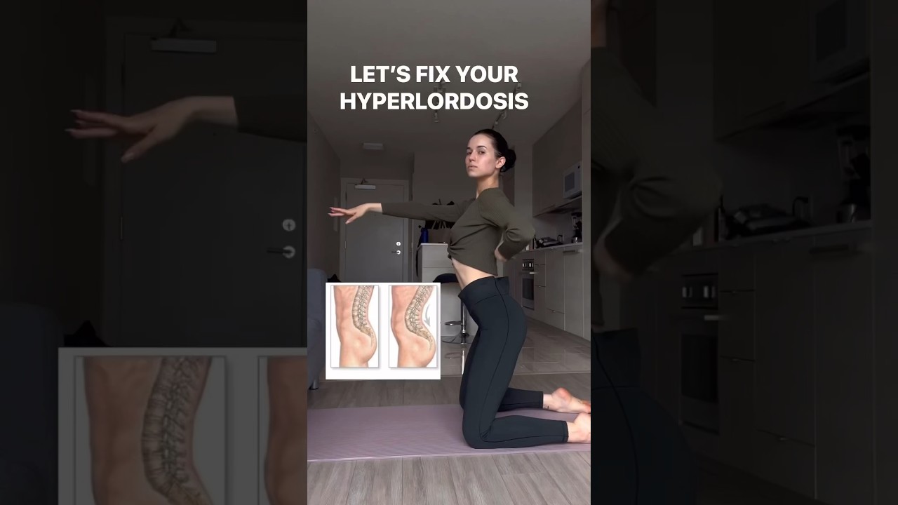 Here&rsquo;s how you FiX your Hyperlordosis 🙏🏼😍