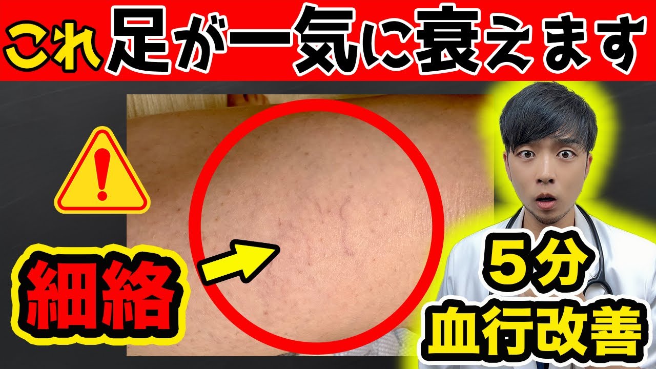 【放置危険】足の血流が止まる寸前にだけ現れる危険サイン【5分で改善】下肢静脈瘤(細絡)の症状/治療/予防法を現役医師が解説