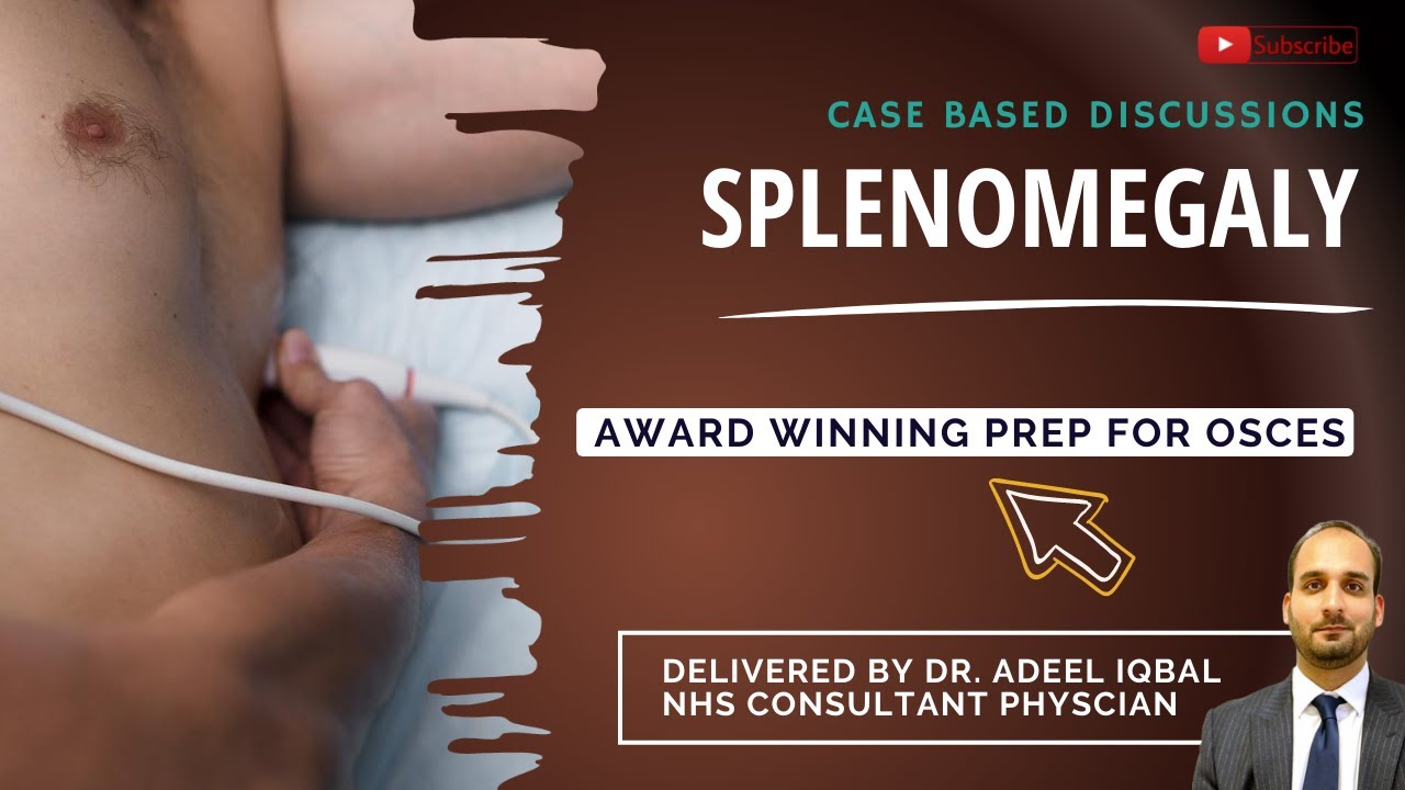 Splenomegaly - Abdominal - BEST OSCE Preparation for Medical Student Exams