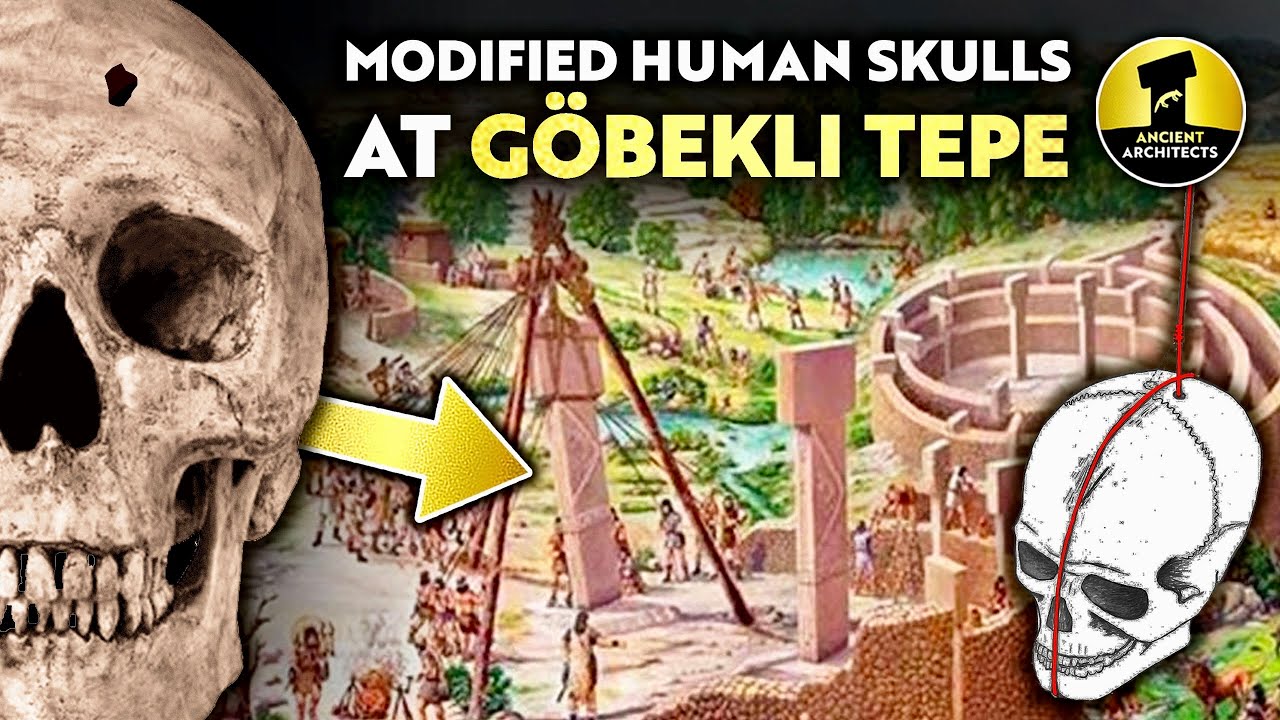 11,000-Year-Old Modified Human Skulls at G&ouml;bekli Tepe | Ancient Architects