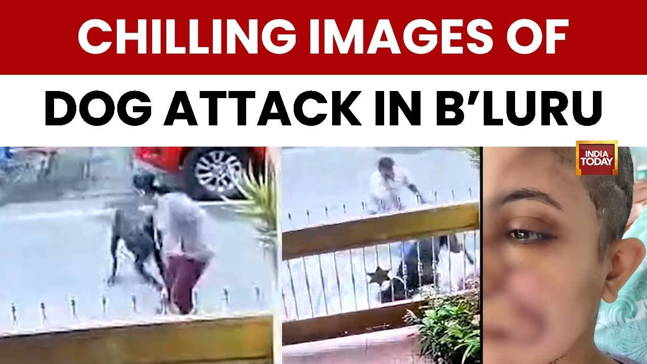 Bengaluru Dog Attack: Pet Dog Attacks Woman, Victim Receives 50 Stitches, FIR Filed Aginst Owner