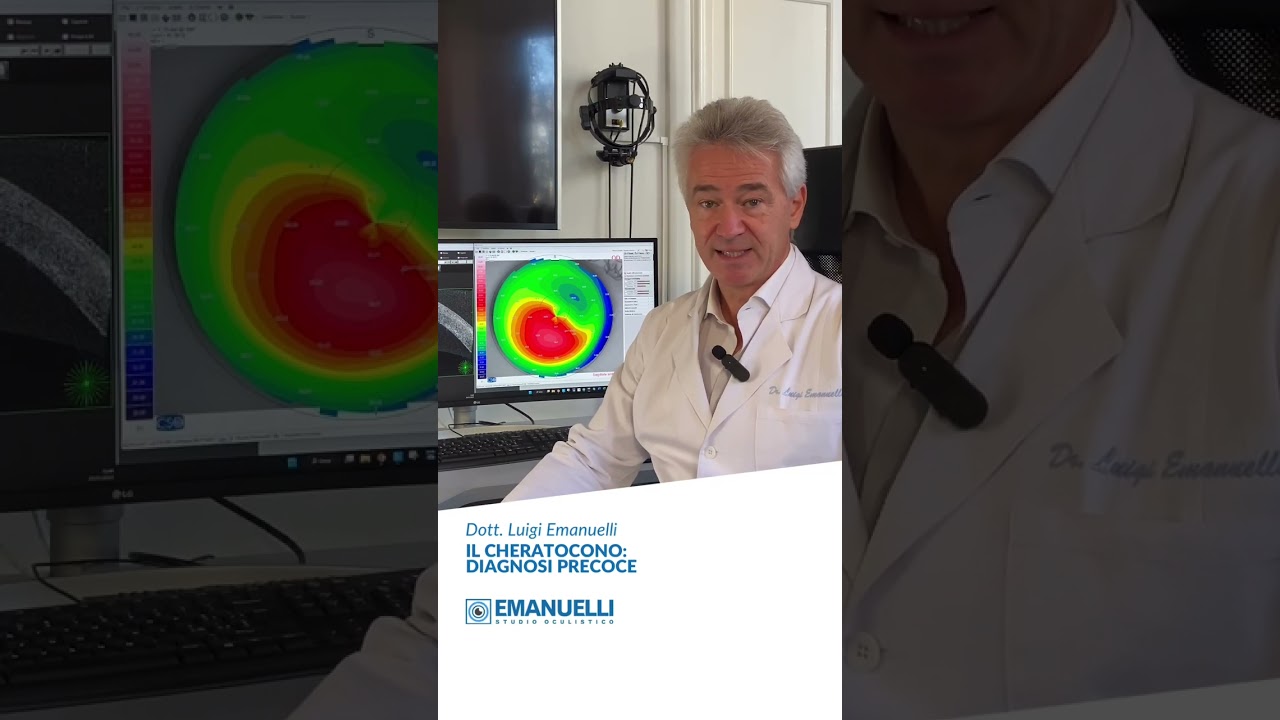 Diagnosi precoce del CHERATOCONO