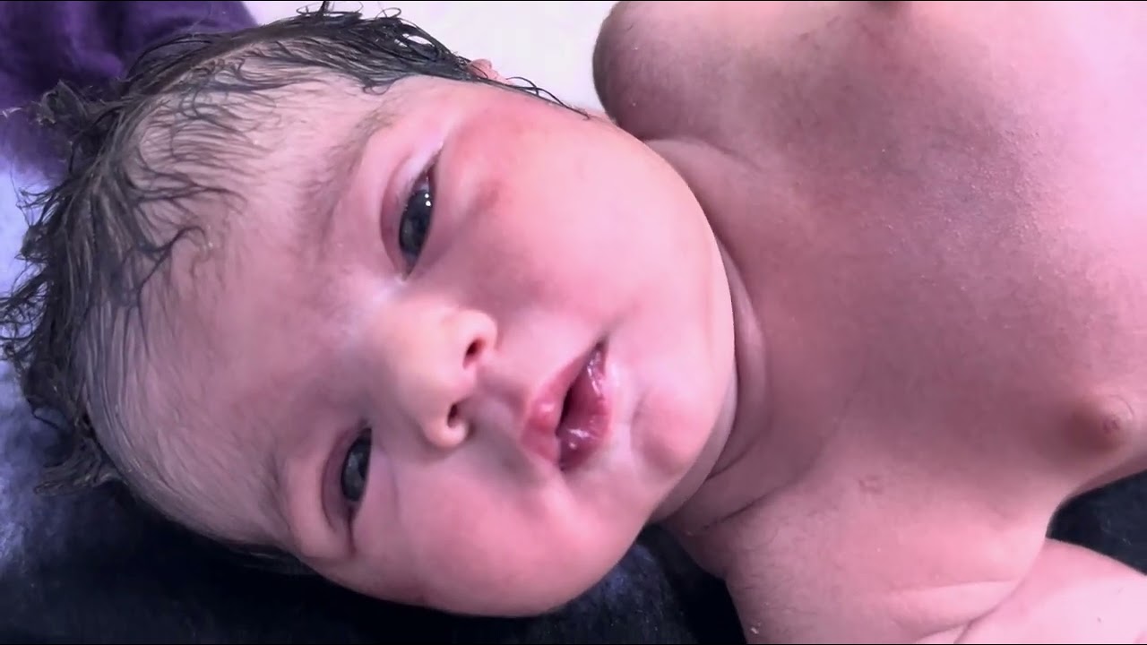 Newborn Baby in Good Condition Feeding WellNICU Observation Update 