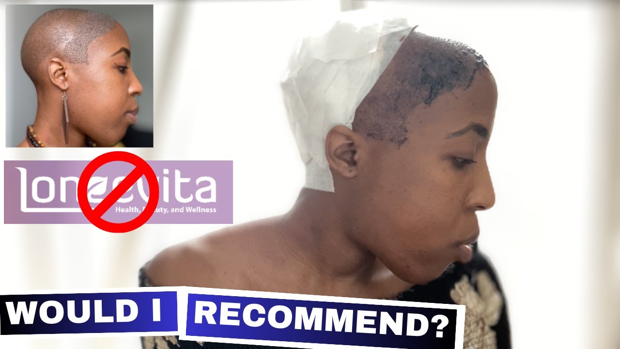 LONGEVITA против HEVA CLINIC | Почему я НЕ выбрала Longevita для пересадки африканских волос