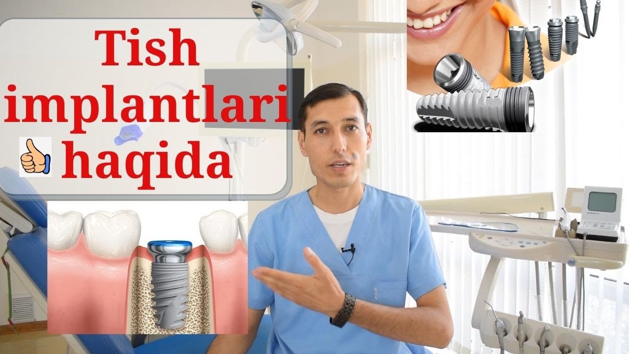 Имплант тишлар минус ва плюс тамонлари. Implant tishlar ijobiy va salbiy taraflari.