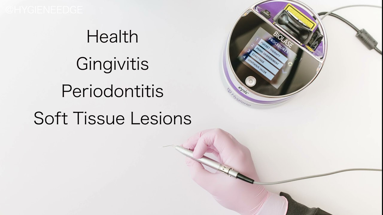 What The Dental Hygiene Laser Does with Biolase Epic Hygiene