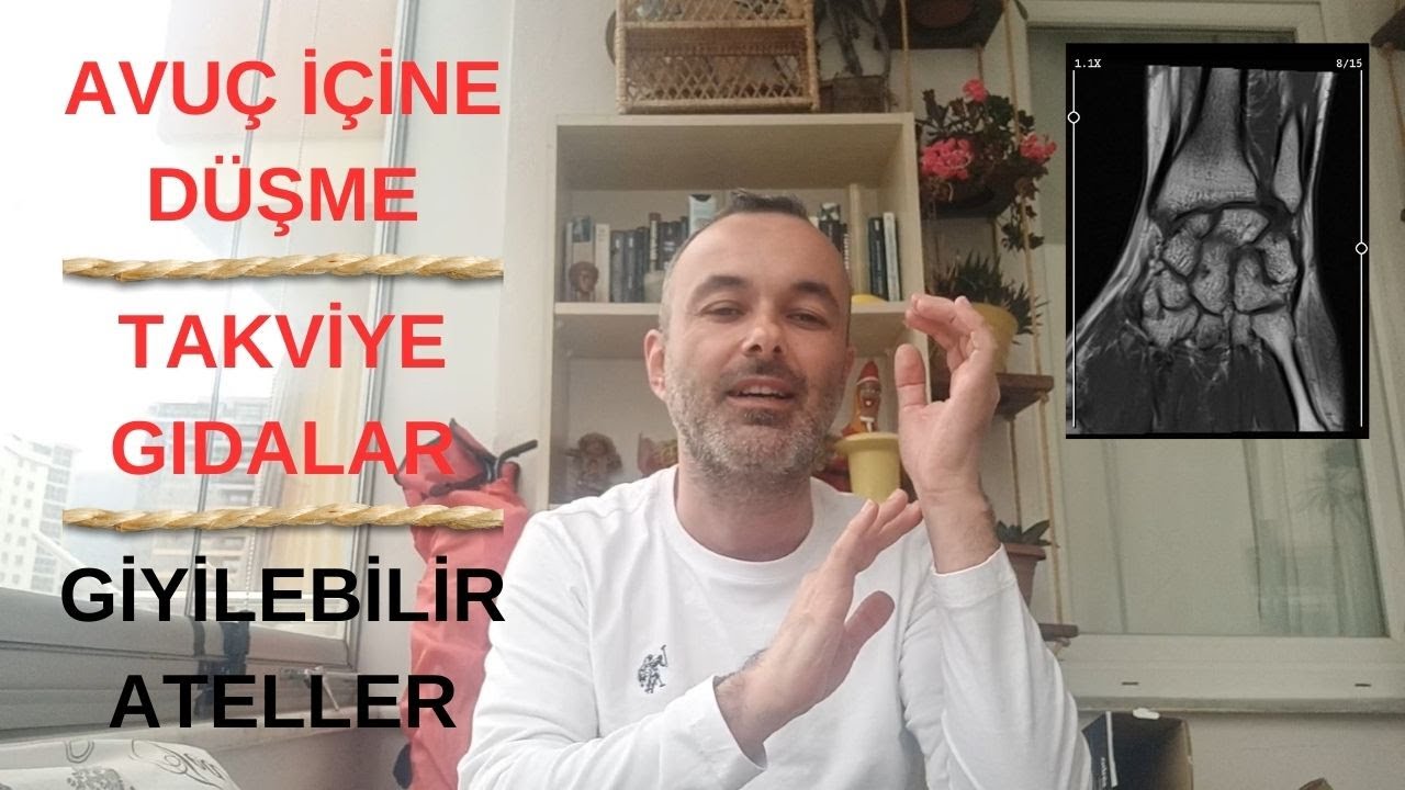 El Bilek Kırığı (Skafoid) Hakkında Her şey