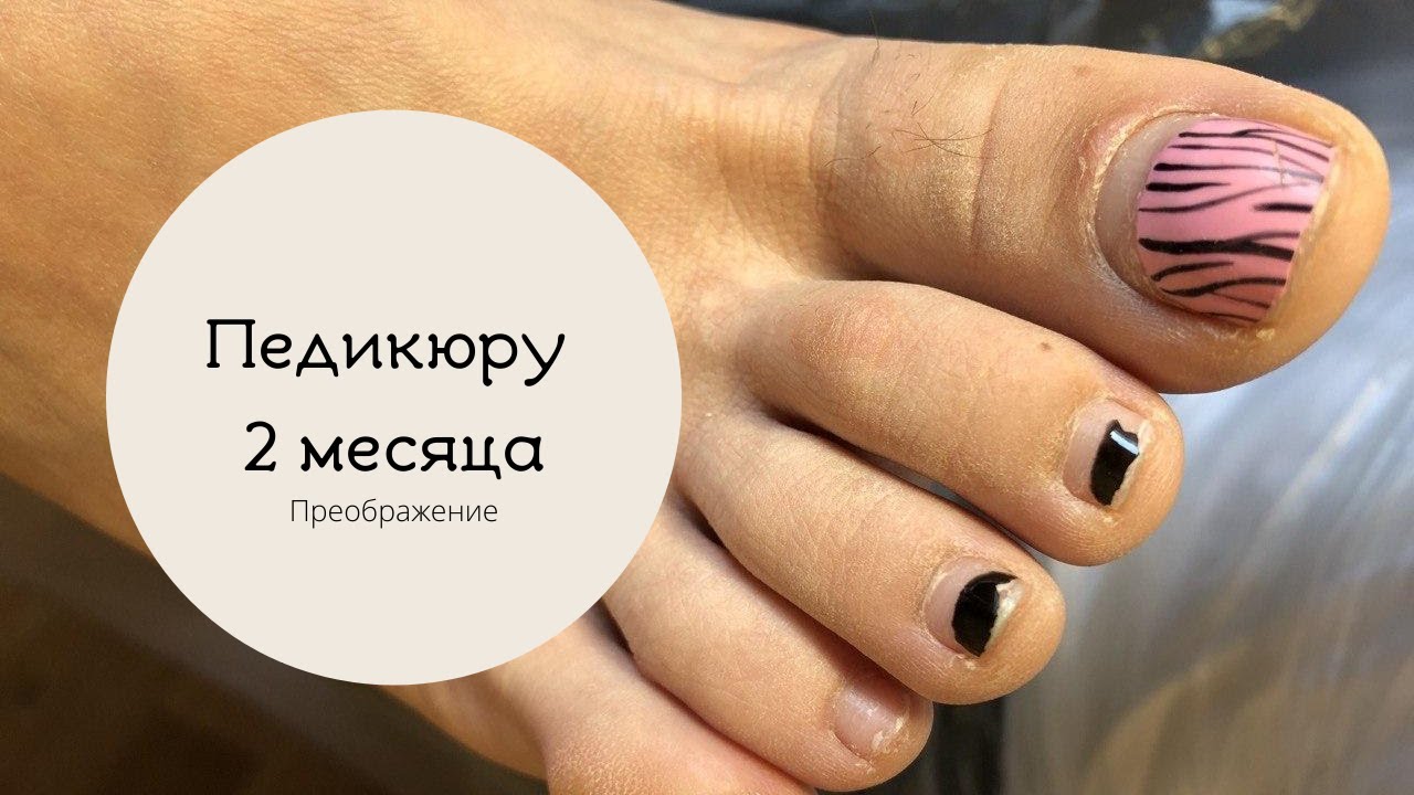 Педикюру 2 месяца | Преображение ножек | Комбинированный педикюр