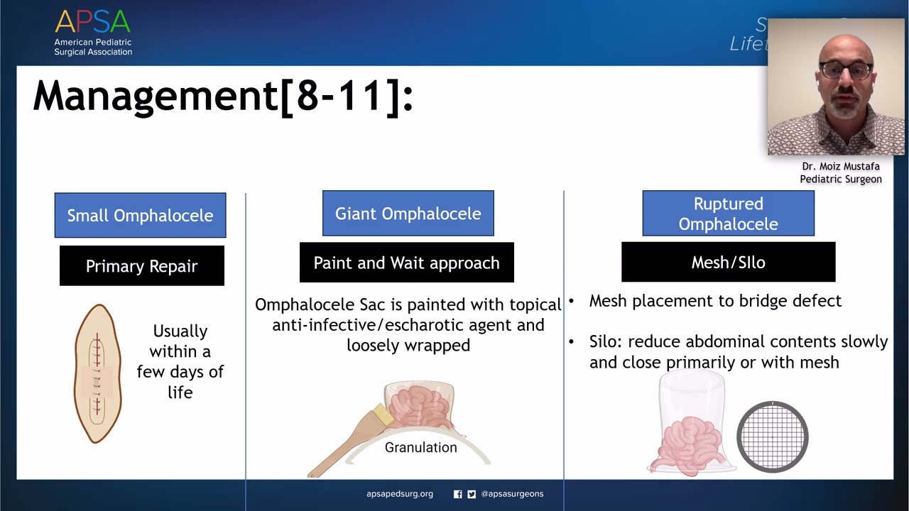 APSA Expert Talk - Ompalocele