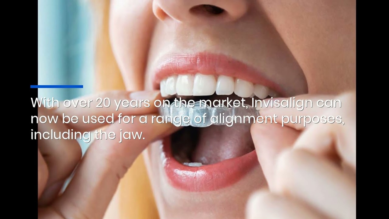 Mt Eden 5-Star Reviewed Orthodontics Dentist Offers Clear Braces to Align Jaw & Straighten Teeth