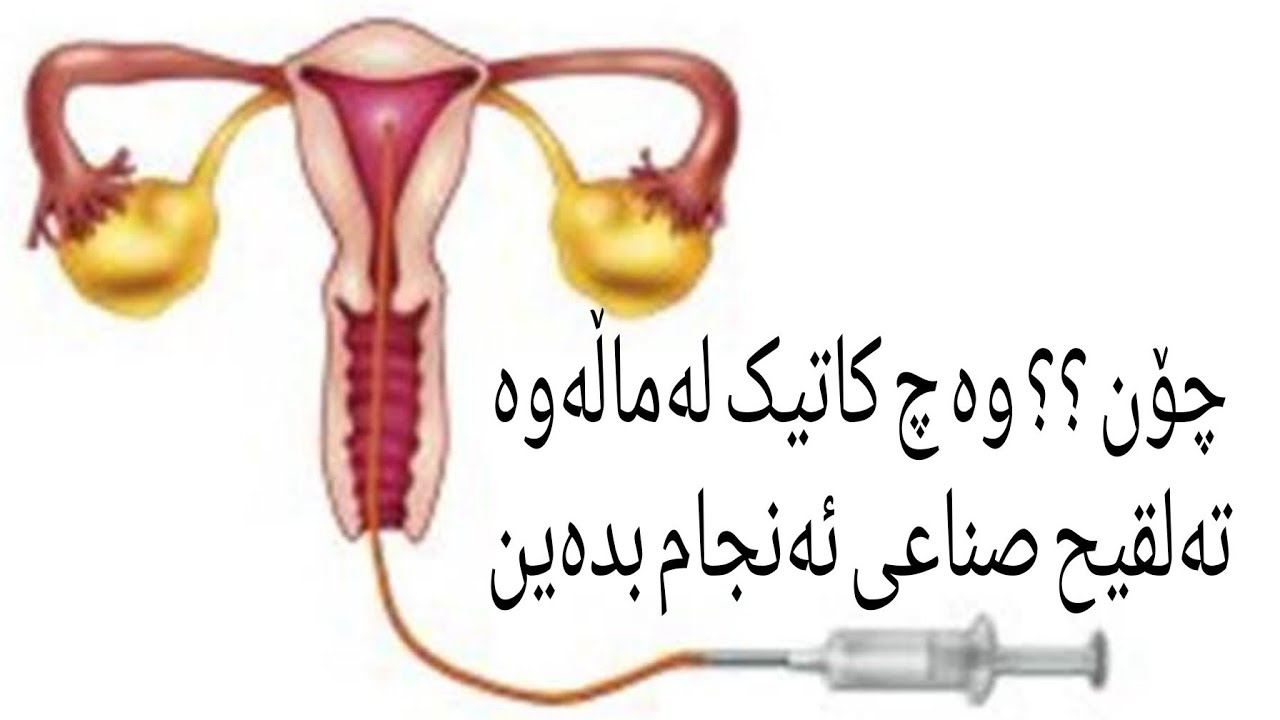 چۆن لە ماڵەوە تەلقیح صناعی ئەنجام بدەین