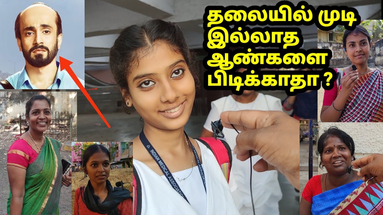 வழுக்கை தலை ஆண்களை பிடிக்காதா ? பெண்கள் சொல்வது என்ன ?