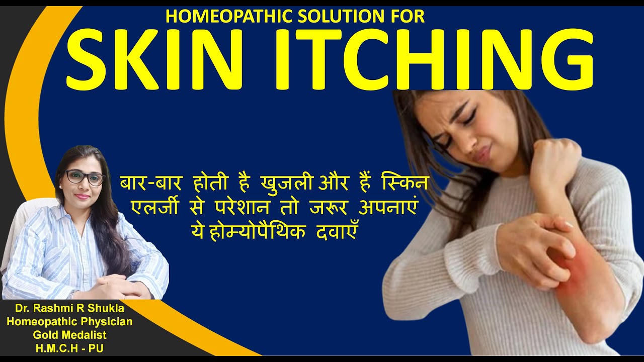खुजली से तुरंत छुटकारा दिलाये ये होम्योपैथिक दवाएं |Skin itching treatment