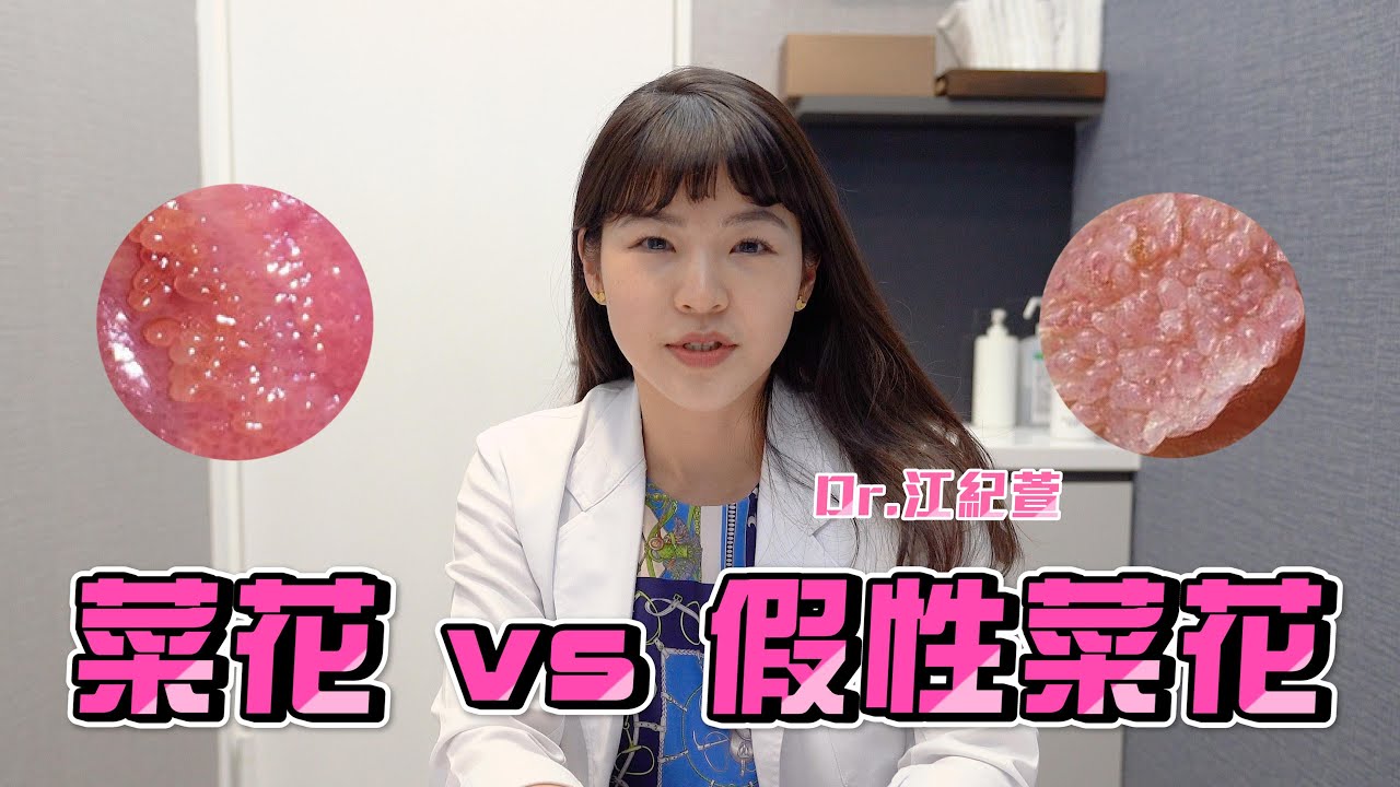 OMG! 我好像得菜花了!? 皮膚科醫師教你如何分辨真假菜花🥦