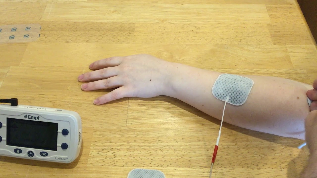 NMES and FES demonstration; also use of a movable electrode to find motor points
