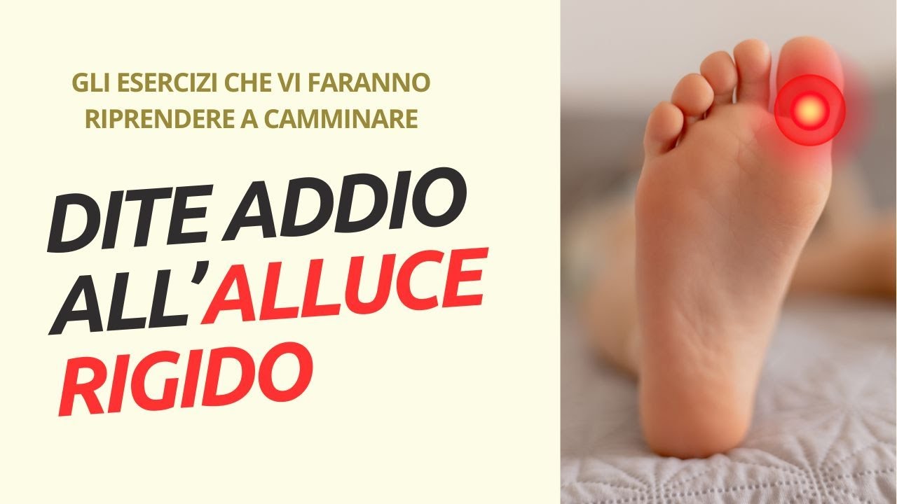 Alluce Rigido: 3 Esercizi Efficaci per Mobilit&agrave; e Sollievo dal Dolore