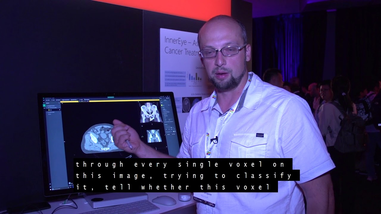 Tech Showcase:&nbsp;Project InnerEye &ndash; Assistive AI for Cancer Treatment