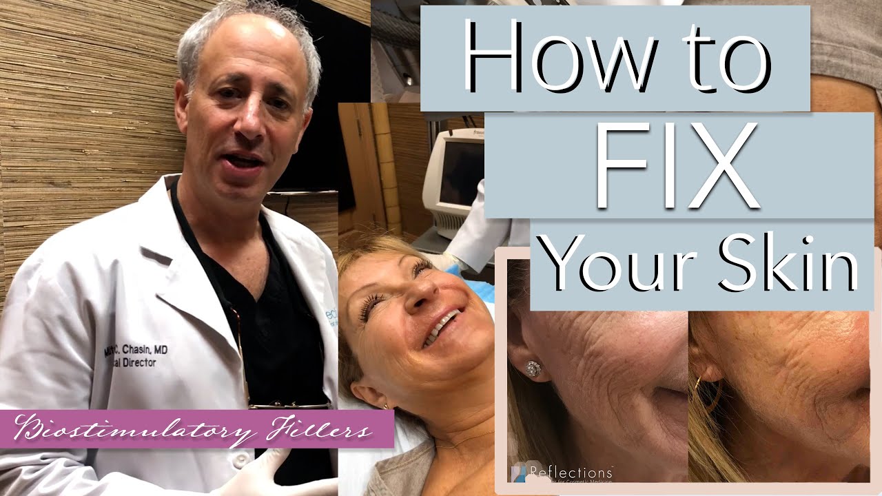 Biostimulatory Fillers - How to Fix Your Skin with #HyperdiluteRadiesse & #Sculptra