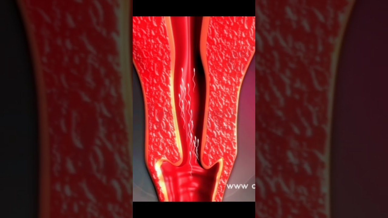 оплодотворение (3D-анимация)