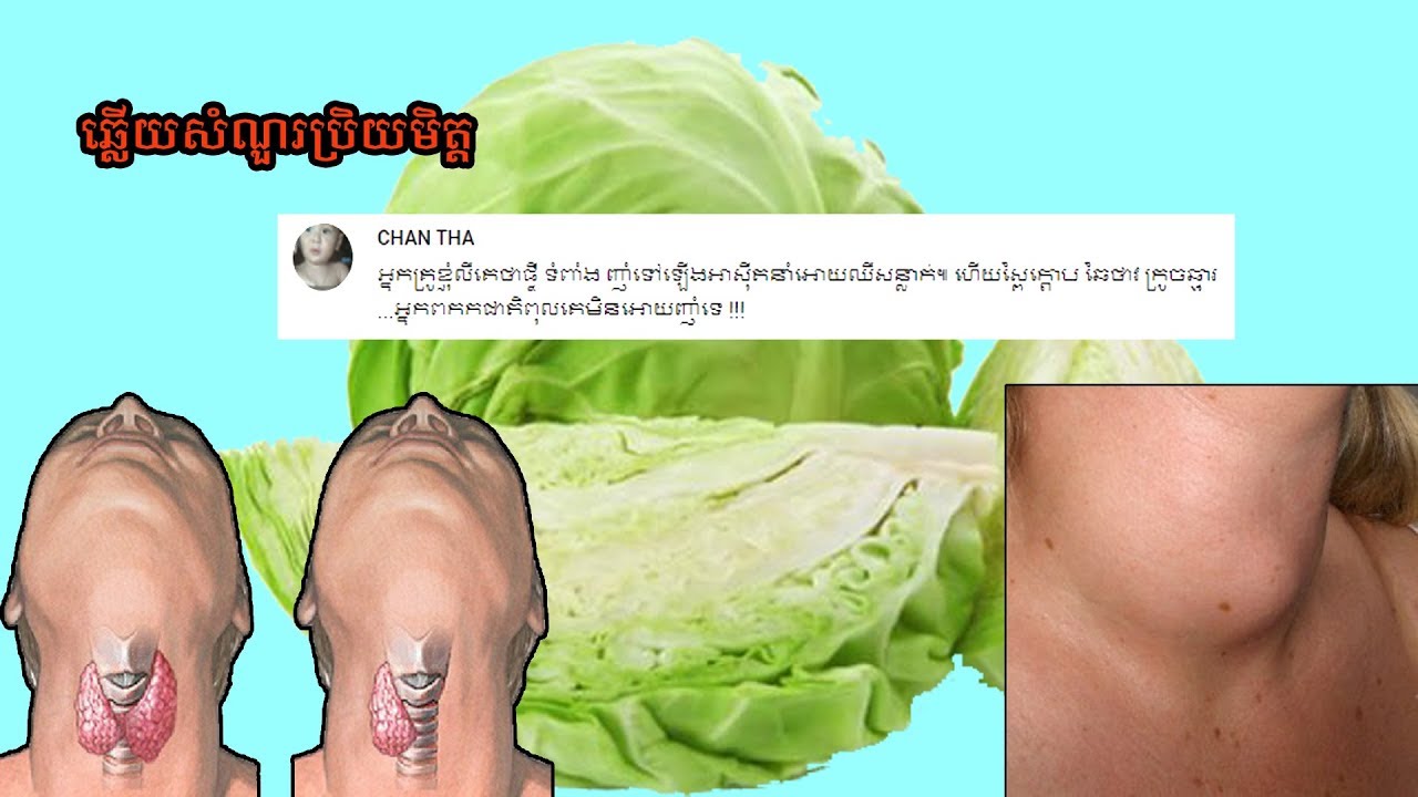 ឆ្លើយសំណួរប្រិយមិត្ត៖ តើអ្នកឡើងជាតិពុលក្នុងក្រពេញទីរ៉ូអ៊ីដ អាចញ៉ាំស្ពៃក្តោប ក្រូចឆ្មា ឬឆៃថាវ បានឬទេ?