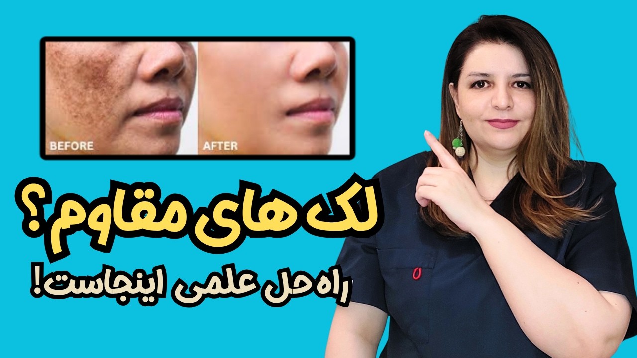 چرا باید درمان لک رو همین الان شروع کنی؟ 🍂